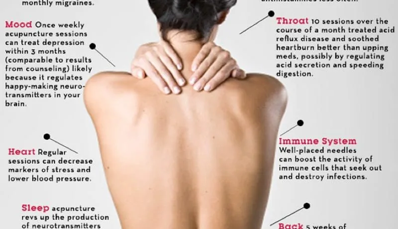 accupuncture2 accupuncture2